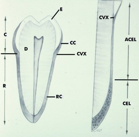 Cementum - Classification Diagram 1 | School of Dental ... cervix diagram 