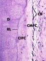 Cementogenesis - Reparative Cementum | School of Dental Medicine ...