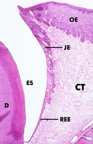 Tooth Eruption and Formation of the Junctional Epithelium Diagram 2 ...